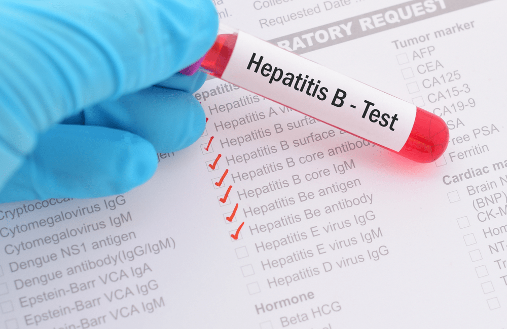 Pekan Hepatitis B: Kenali Lebih Jauh Fakta Dibalik Mitos Hepatitis B ...